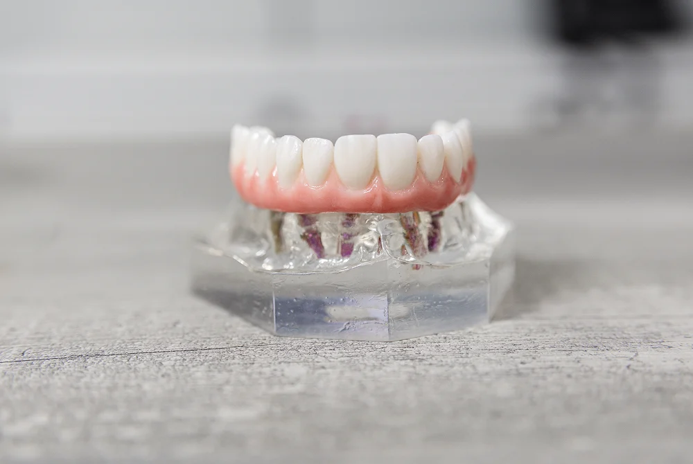 Show Off a Complete Smile With Teeth