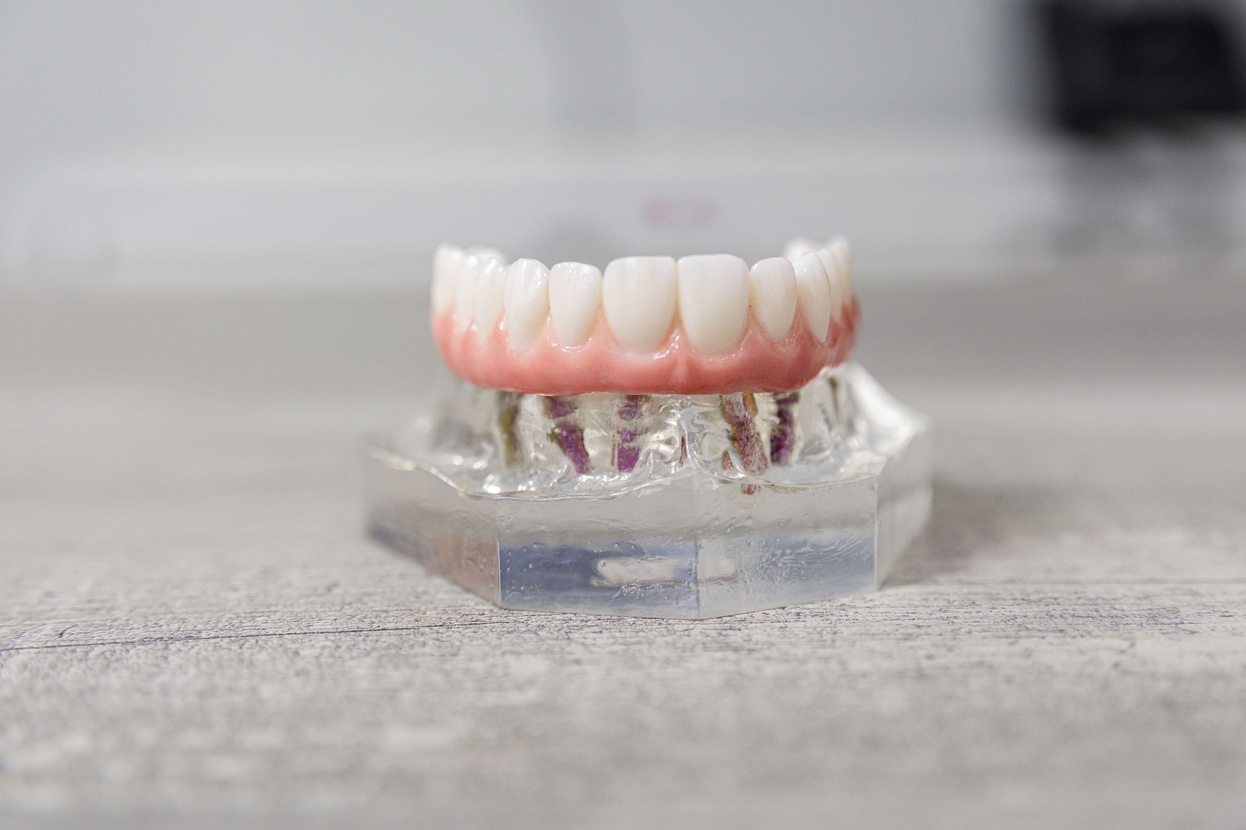 Teeth in a Day